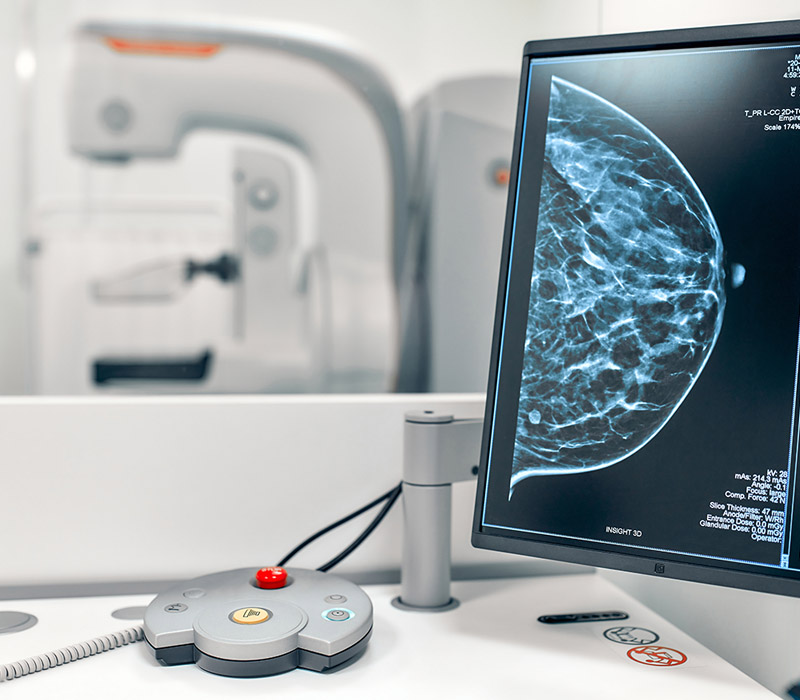 mamografia-digital-dimagem